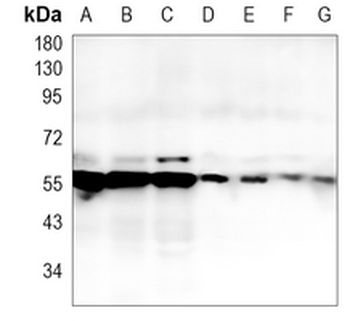 TXNRD1 Rabbit Monoclonal Antibody