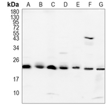 RAB9A Rabbit Monoclonal Antibody