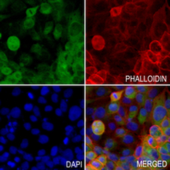 ACTL8 Rabbit Monoclonal Antibody