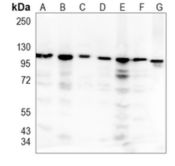 MVP Rabbit Monoclonal Antibody