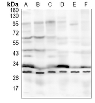 BDNF Rabbit Monoclonal Antibody