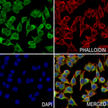 BDNF Rabbit Monoclonal Antibody