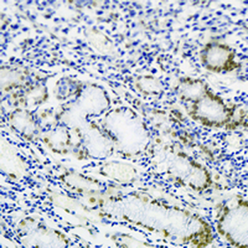 TFIIF RAP 30 Rabbit Monoclonal Antibody
