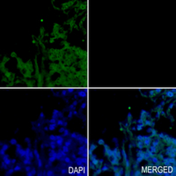 HSP70 Rabbit Monoclonal Antibody