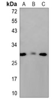 CHMP2B Rabbit Monoclonal Antibody
