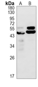 CaMK2 alpha Rabbit Monoclonal Antibody