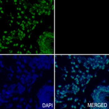 ASH2L Rabbit Monoclonal Antibody