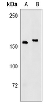 CD280 Rabbit Monoclonal Antibody