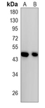 P4H-TM Rabbit Monoclonal Antibody