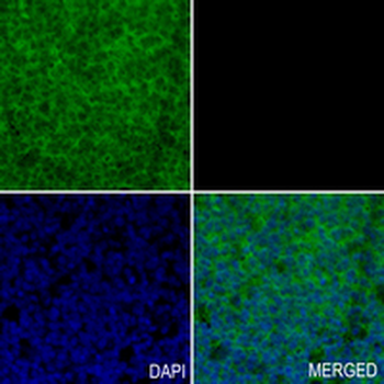 P4H-TM Rabbit Monoclonal Antibody