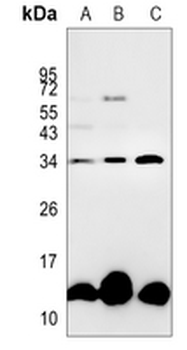 ICAT Rabbit Monoclonal Antibody