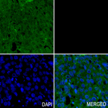 ICAT Rabbit Monoclonal Antibody