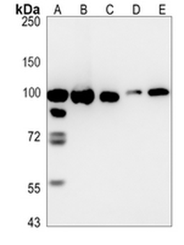 TRPV5 Rabbit Monoclonal Antibody