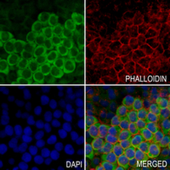 TRPV5 Rabbit Monoclonal Antibody