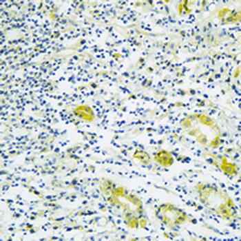 PIST Rabbit Monoclonal Antibody