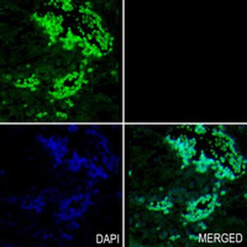 PREB Rabbit Monoclonal Antibody
