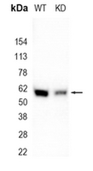 CRMP-5 Rabbit Monoclonal Antibody