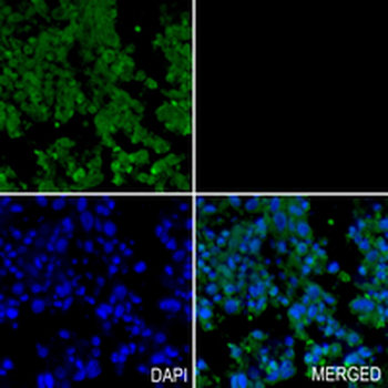 G9A Rabbit Monoclonal Antibody
