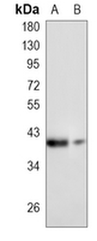 FBXO32 Rabbit Monoclonal Antibody