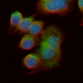 FBXO32 Rabbit Monoclonal Antibody
