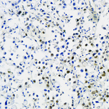 BAF57 Rabbit Monoclonal Antibody