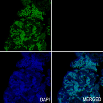 BAF155 Rabbit Monoclonal Antibody