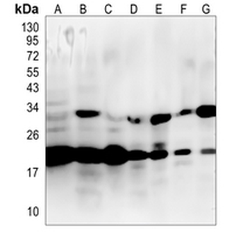 AKAP14 Rabbit Monoclonal Antibody