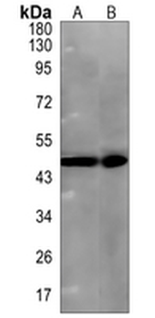 Rab 9 p40 Rabbit Monoclonal Antibody