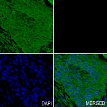 Rab 9 p40 Rabbit Monoclonal Antibody