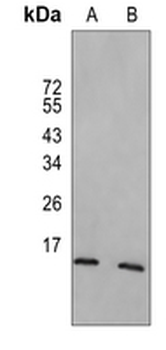 SUMO4 Rabbit Monoclonal Antibody
