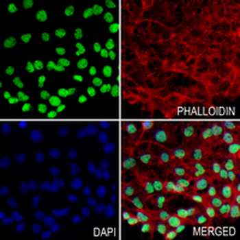 SUMO4 Rabbit Monoclonal Antibody
