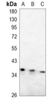 SMN Rabbit Monoclonal Antibody