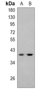 p38 Rabbit Monoclonal Antibody