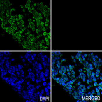 p38 Rabbit Monoclonal Antibody