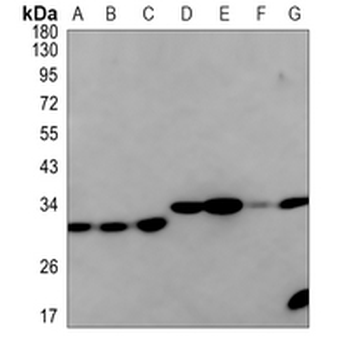 IGFBP7 Rabbit Monoclonal Antibody