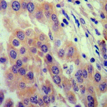 IGFBP7 Rabbit Monoclonal Antibody