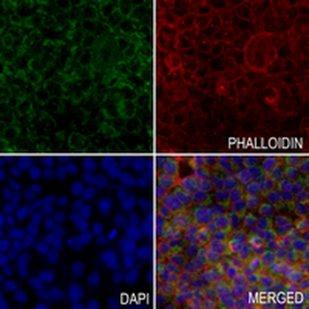 IGFBP7 Rabbit Monoclonal Antibody