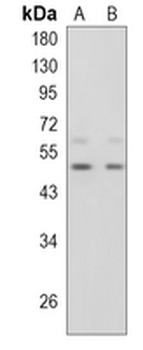 SHH Rabbit Monoclonal Antibody