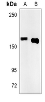 SMC1A Rabbit Monoclonal Antibody