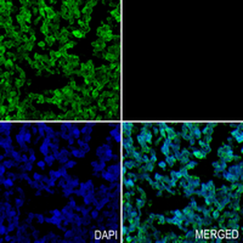 SMC1A Rabbit Monoclonal Antibody