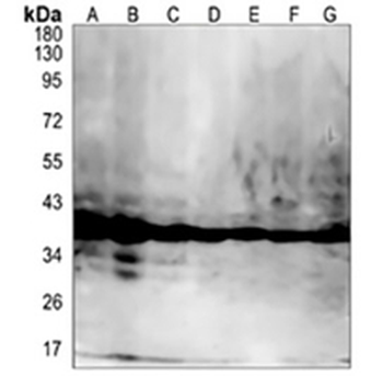 Cyclophilin D Rabbit Monoclonal Antibody