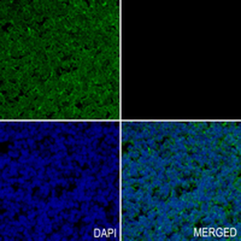 PDE4B Rabbit Monoclonal Antibody