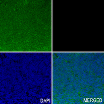 CCT2 Rabbit Monoclonal Antibody