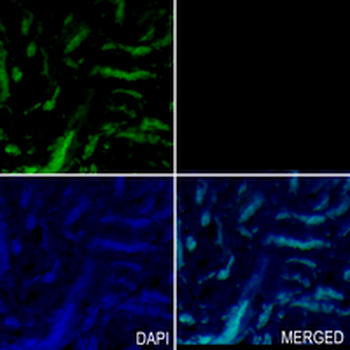 DCAF7 Rabbit Monoclonal Antibody