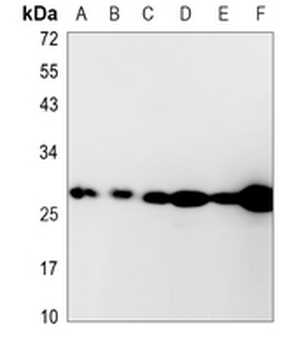 AK2 Rabbit Monoclonal Antibody