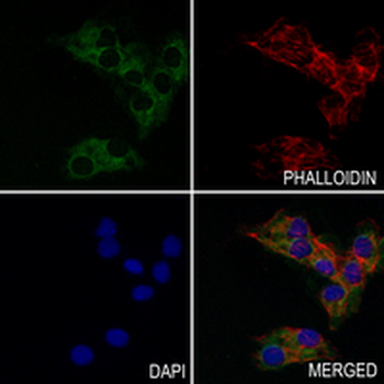 AK2 Rabbit Monoclonal Antibody