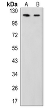 TRPC1 Rabbit Monoclonal Antibody
