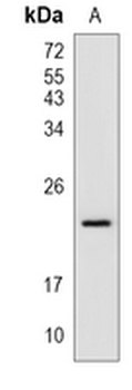 p21 Rabbit Monoclonal Antibody