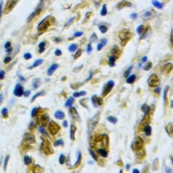 p21 Rabbit Monoclonal Antibody