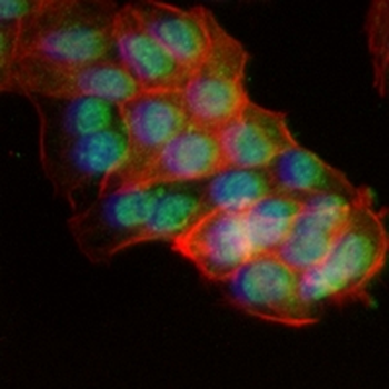 p21 Rabbit Monoclonal Antibody